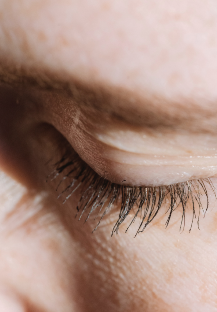 Blépharoplastie​ Clinique Duchesse Anne Rennes