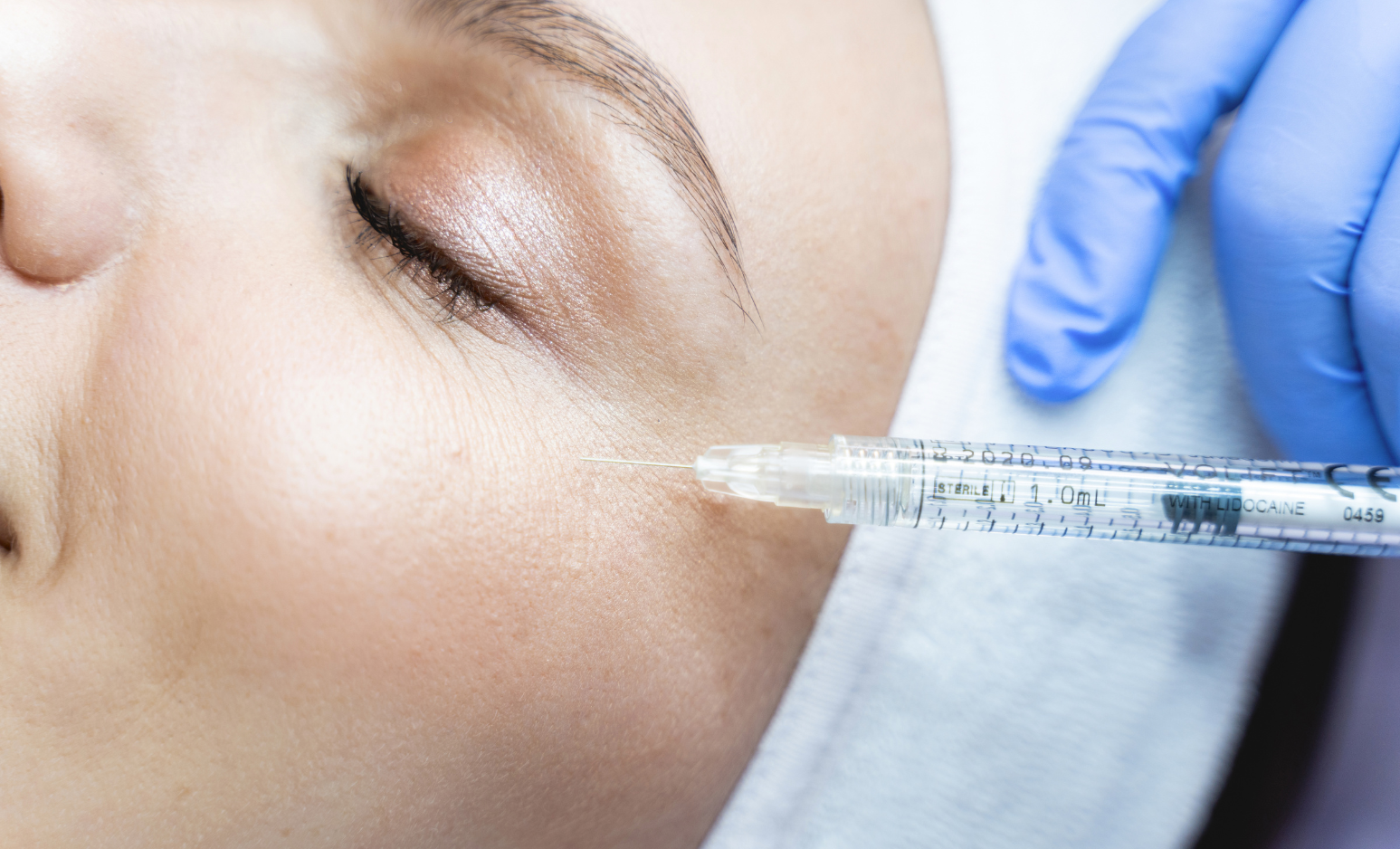 Injections toxine botulinique