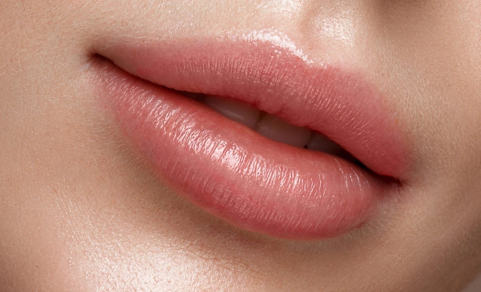 Augmentation volume des lèvres
