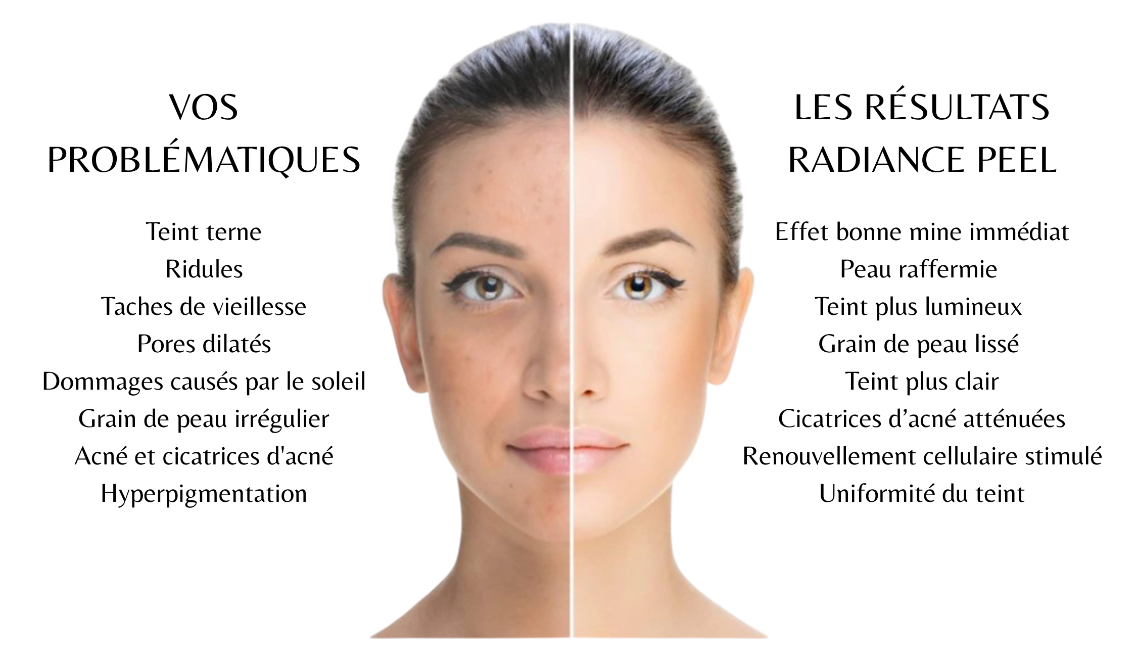 radiance peel