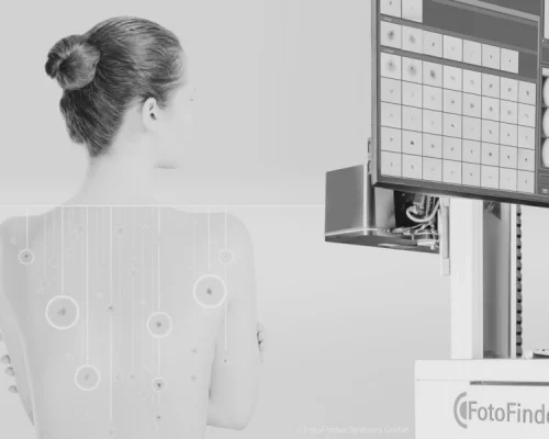 FotoFinder Rennes Clinique Duchesse Anne